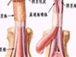 包皮龟头炎的发病原因有哪些...